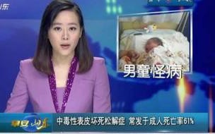 中毒性表皮坏死松解症症状和体征 中毒性表皮坏死松解症